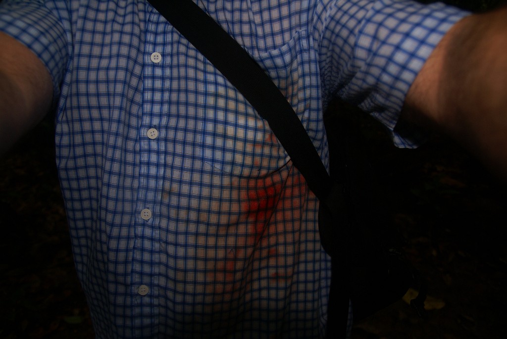 DSC02830.JPG - Ein Blutegel hatte sich unter mein Hemd geschmuggelt, sieht fies aus, war aber nicht schlimm.